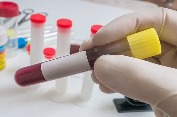 El investigador sostiene el tubo de prueba con sangre y etiqueta en blanco como marco para el texto personalizado — Foto de Stock