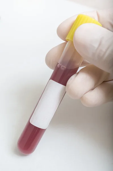 Scientist holds test tube with blank frame for custom text. — Stock Photo, Image