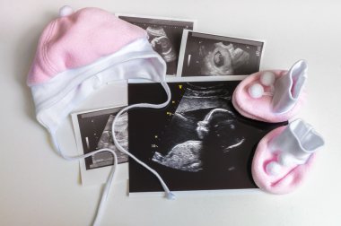 Çok sayıda ultrason resimleri ve kız bebek için giyim. Gebelik kavramında bekliyor.