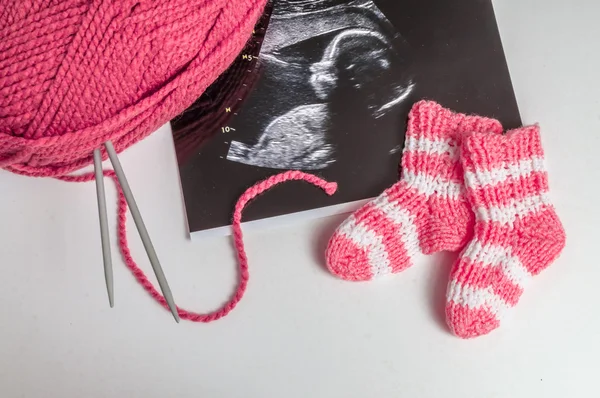 Концепция беременности. вязание обуви для малышки и ультразвуковая картинка — стоковое фото