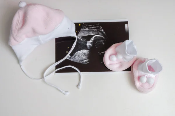 Ropa de bebé y imagen de ultrasonido. Esperando en el concepto de embarazo —  Fotos de Stock