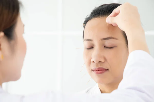 Nahaufnahme Der Handakupunkturtherapie Kopf Des Patienten — Stockfoto