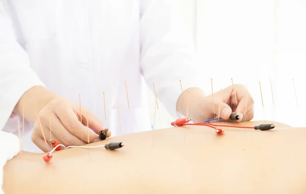 Nahaufnahme Einer Frau Die Sich Einer Akupunkturbehandlung Mit Elektrischen — Stockfoto