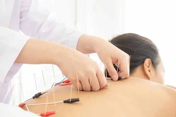 Close Acupuncturist Hands Doing Acupuncture Electrical Stimulation 图库图片