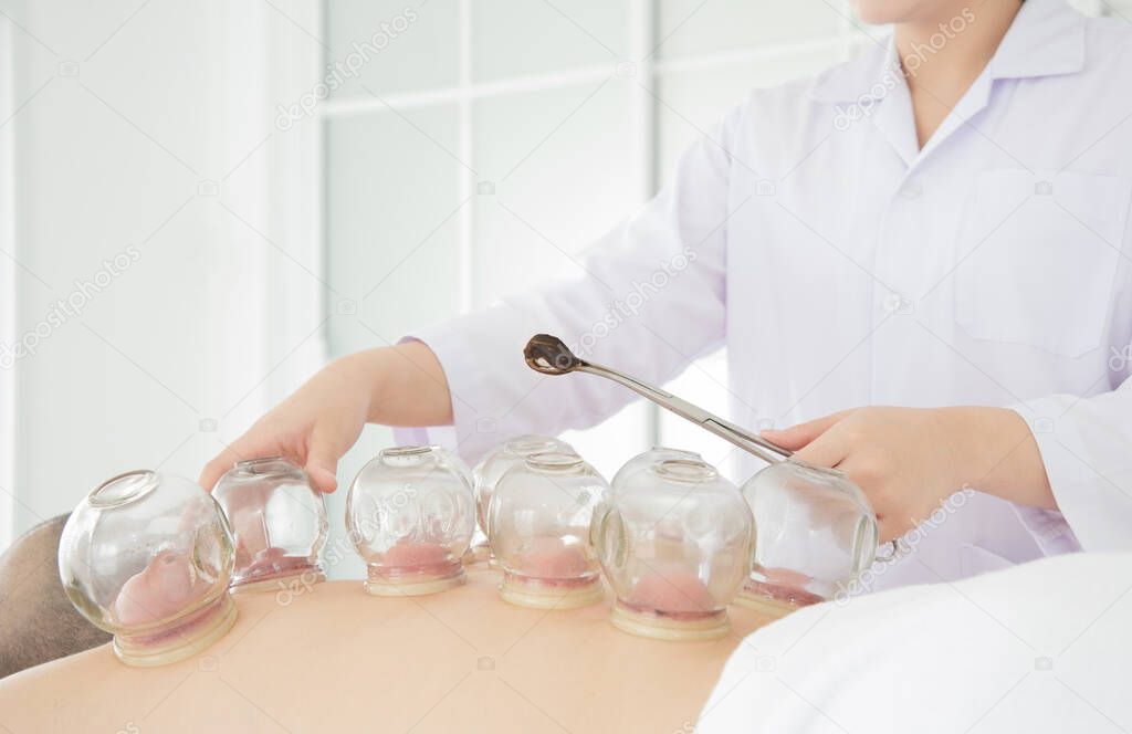 close-up of a therapist giving cupping treatment. 