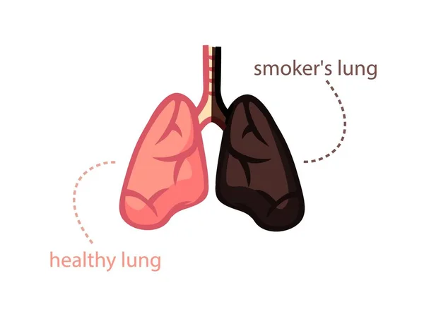Легені курять і здорову людину. Здоровий рожевий орган і чорний з тютюну . — стоковий вектор
