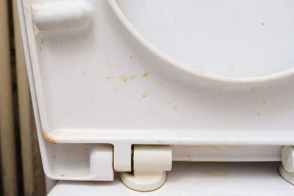 Sucio asiento del inodoro antihigiénico de cerca en el baño público - concepto de limpieza del hogar y del baño —  Fotos de Stock