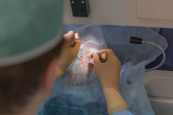 Ophtalmology операція LASIK — стокове фото