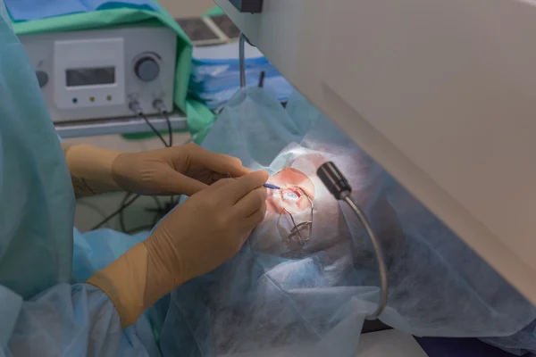 Ophtalmology операція LASIK — стокове фото
