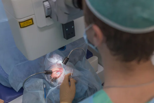 Operasi oftalmologi LASIK — Stok Foto