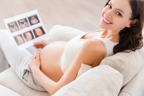 Kobieta w ciąży trzyma zdjęcie rentgenowskie — Zdjęcie stockowe