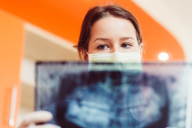 Doktor bir x-ray arıyorsunuz