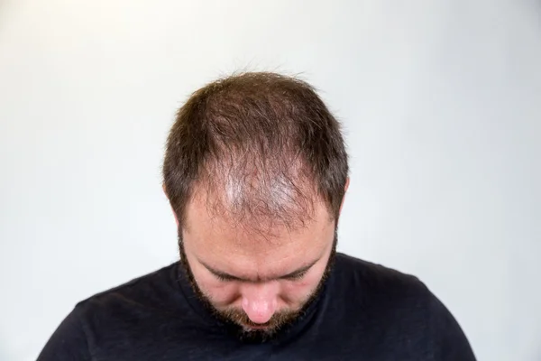 Man in Mid 30s Poses for Studio Portrait — Stock Photo, Image