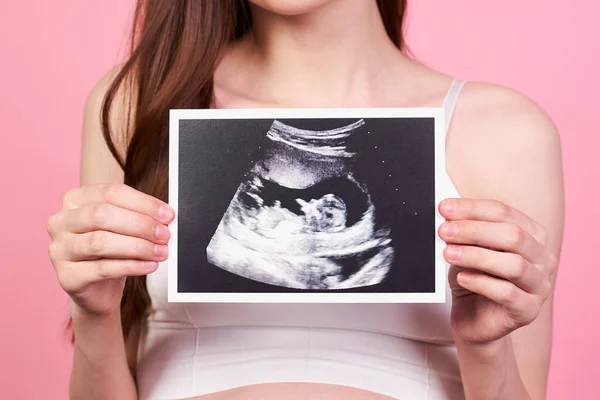 Close Pregnant Woman Her Baby Sonography Happy Expectant Lady Enjoying — Stock Photo, Image