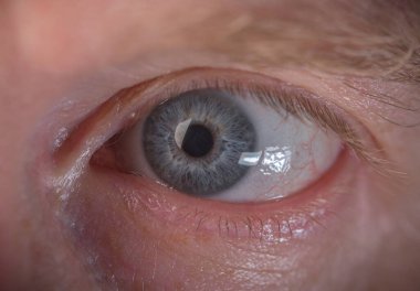 Üst ve alt kirpikli insan gözü.