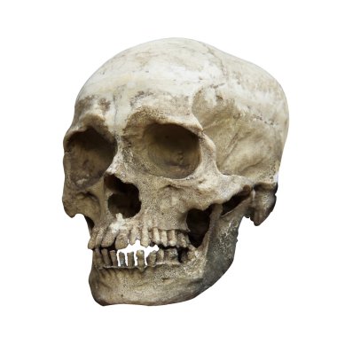 İnsan kafatası ve kırpma yolu yan görünüm.