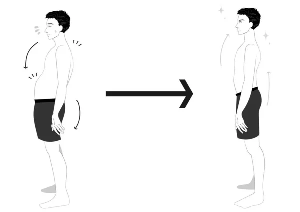 Maschio Vista Laterale Illustrazione Impostato Con Cattiva Postura Buona Postura — Vettoriale Stock