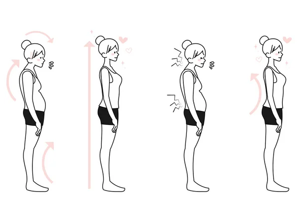 Female Illustration Set Stoop Straight Posture — Stock Vector