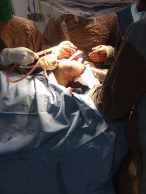 Accidental leg surgery at critical condition by asian doctors