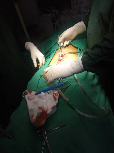 Estômago Câncer Cirurgia Realizando Por Asiático Cirurgiões Equipe — Fotografia de Stock