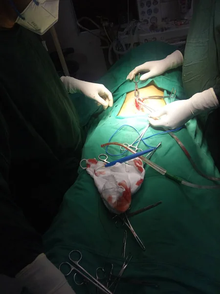 Critical Operation Performing Doctors Stomach Cancer Surgery — Stok fotoğraf