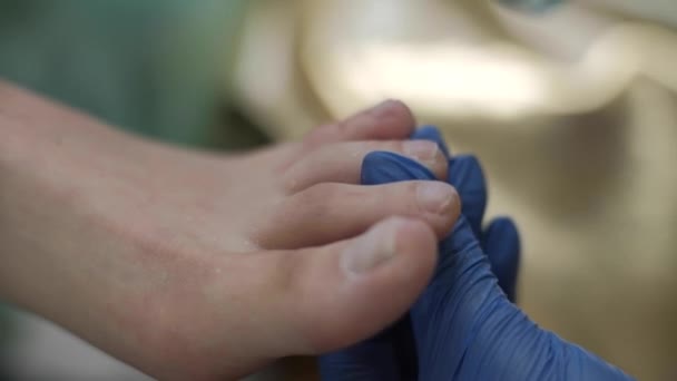 Sprzęt Medyczny Pedicure Aparaturą Wiercenia Paznokci Pacjent Pedicure Pediatrą Kręgarzem — Wideo stockowe