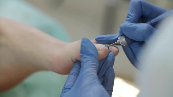 Medizinische Fußpflege Mit Nagelfeilenbohrgerät Patient Auf Pediküre Behandlung Beim Kinderarzt — Stockvideo