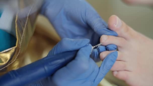 Hardware Medical Pedicure Nail File Drill Apparatus Patient Pedicure Treatment — Stock Video