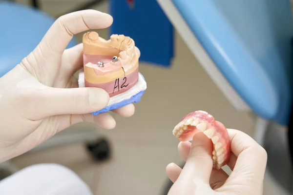 男性歯科医が女性患者にインプラントを見せ — ストック写真