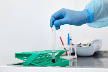 Laboratuvarda kan örneğiyle çalışan bilim adamı.