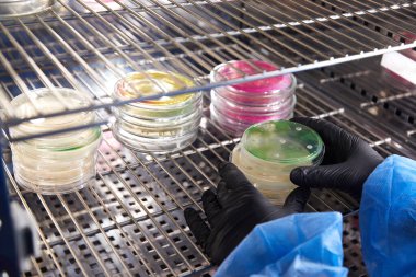 Mikrobiyoloji laboratuvarında petri kabıyla çalışan bir teknisyenin ya da bilim adamının eldivenli eli. Bakteriyel Kültür Medyası. Mikrobiyolog. Bakteriler.