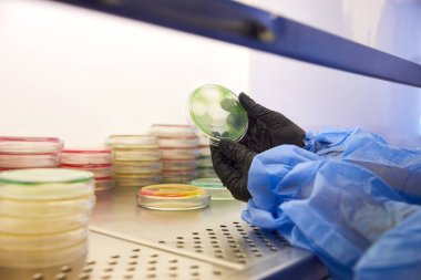 Mikrobiyoloji laboratuvarında petri kabıyla çalışan bir teknisyenin ya da bilim adamının eldivenli eli. Bakteriyel Kültür Medyası. Mikrobiyolog. Bakteriler.