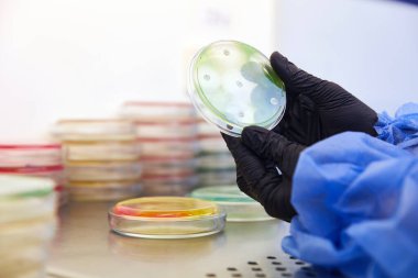 Mikrobiyoloji laboratuvarında petri kabıyla çalışan bir teknisyenin ya da bilim adamının eldivenli eli. Bakteriyel Kültür Medyası. Mikrobiyolog. Bakteriler.