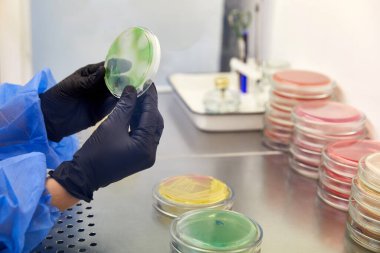 Mikrobiyoloji laboratuvarında petri kabıyla çalışan bir teknisyenin ya da bilim adamının eldivenli eli. Bakteriyel Kültür Medyası. Mikrobiyolog. Bakteriler.