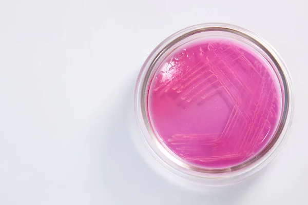 Mikrobiológiai Laboratórium. Petri ételek különböző baktériummintákkal — Stock Fotó