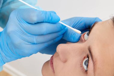 Doktor gözünden numune alıyor.