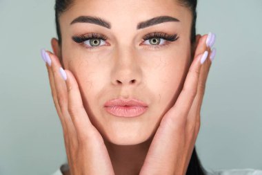 Yapay kirpik kaybı sorunu olan bir kadın. Yüzünün her yerinde kirpikleri dökülmüş.