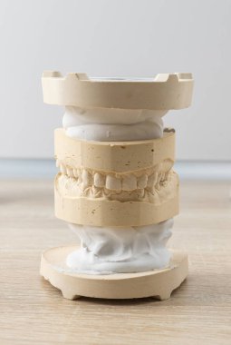 Alçıtaşından yapılmış insan dişlerinin diş modeli. diş izi