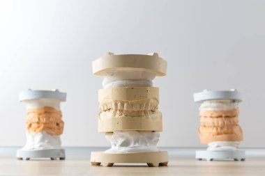 Alçıtaşından yapılmış insan dişlerinin diş modeli. diş izi