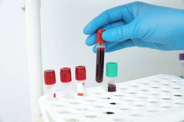 Laboratuvarda kan örneğiyle çalışan bilim adamı.