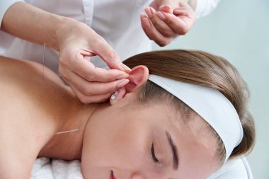 Beautiful woman relaxing on a bed having acupuncture treatment with needles in and around her ear. Alternative Therapy concept clipart