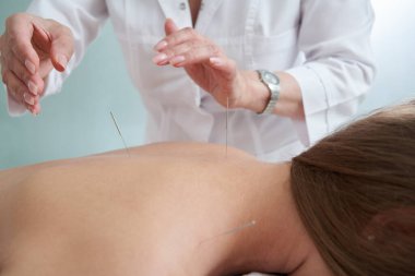 Doktor, kaplıca salonundaki akupunktur tedavisi için kadınlara iğne batırıyor. Alternatif Tıp Konsepti