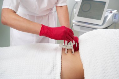 Kozmetik uzmanı, hastanın belindeki yağ oranını ölçmek için Caliper kullanıyor. Diyet ve kilo kaybı kavramı