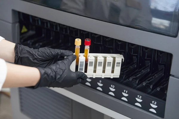 Female Research Scientist Putting Test Tube with Blood Sample into Analyzer Medical Machine. Scientist Works with Modern Medical Equipment in Laboratory — Stock Photo, Image