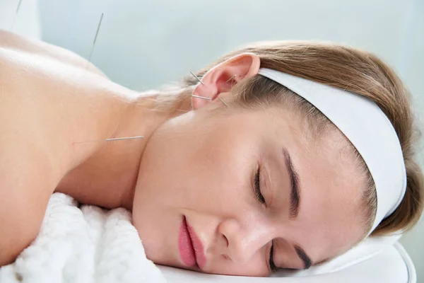 美丽的女人躺在床上休息，用针头在她的耳朵里和周围进行针灸治疗。替代治疗概念 — 图库照片