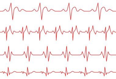 Farklı ritimlerde kırmızı kalp atışı elektrokardiyogramı koleksiyonu