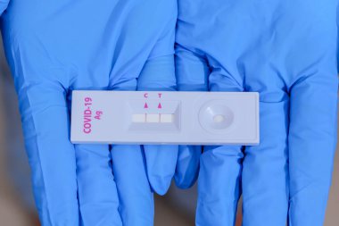 Mavi tıbbi eldiven giyen ve COVID-19 (SARS-CoV-2) kullanan bir kadın, evdeki Hızlı Tespit testine yardımcı olmak için ilk Antijen Test kiti cihazı. Pozitif COVID-19 salgını.