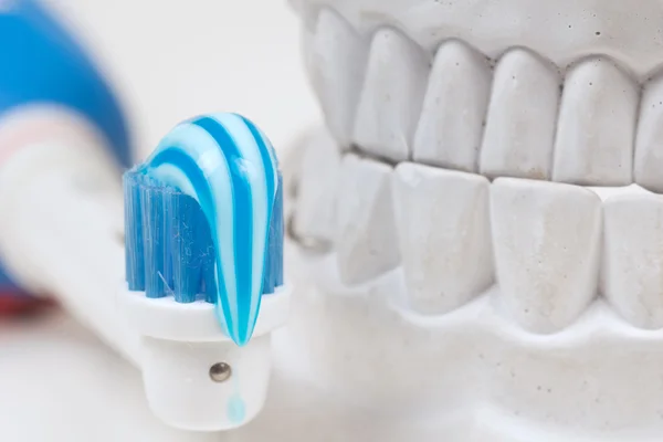 Dental mould — Stock Photo, Image