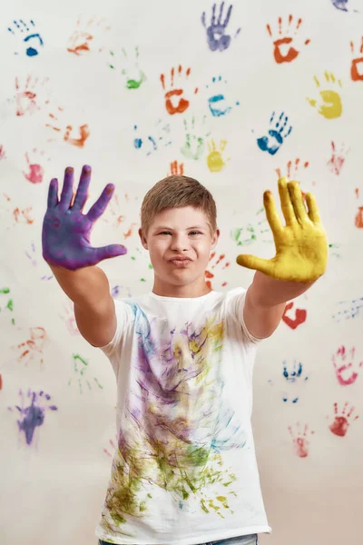 Felice ragazzo disabile con la sindrome di Down guardando la fotocamera mentre allungava le mani dipinte con vernici colorate pronte per le stampe a mano sul muro — Foto Stock
