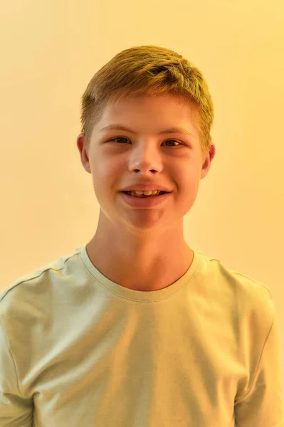 Portrait of joyful disabled boy with Down syndrome smiling at camera while posing isolated over yellow light background — Stock Photo, Image